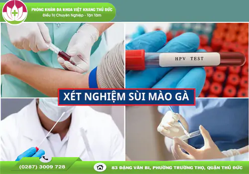 xet-nghiem-sui-mao-ga-o-dau-chinh-xac-cho-ket-qua-nhanh-1226