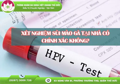 xet-nghiem-sui-mao-ga-tai-nha-co-chinh-xac-khong-2019