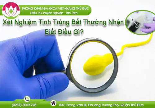 dia-chi-xet-nghiem-tinh-trung-bat-thuong-uy-tin-tai-sai-gon-1064